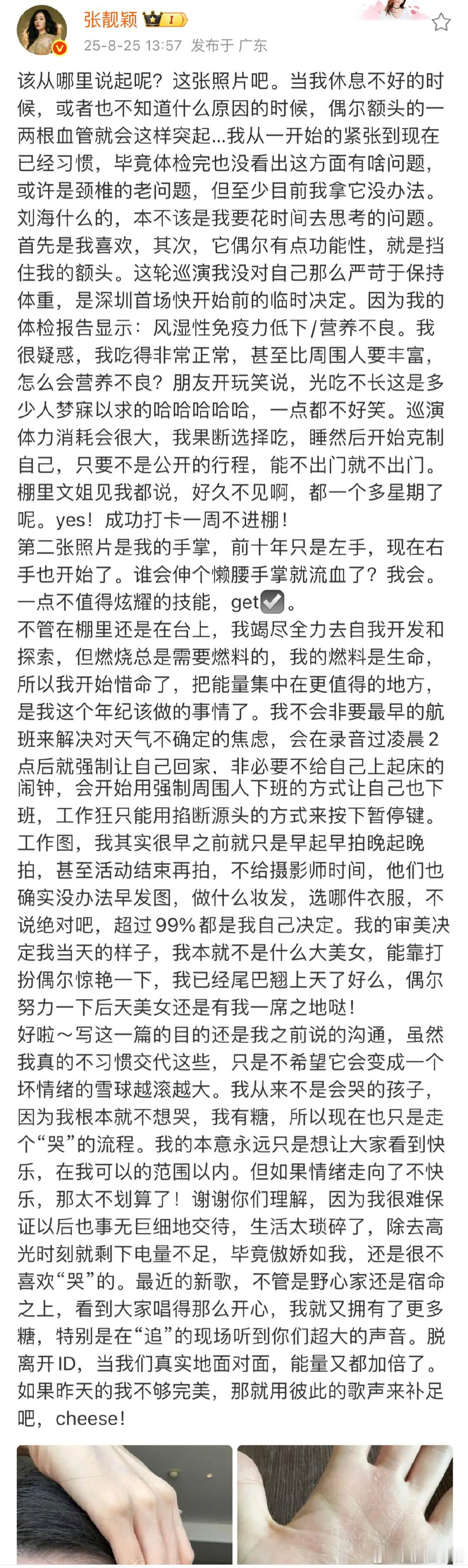 张靓颖伸个懒腰右手掌就流血了张靓颖谁会伸个懒腰手掌就流血了看到张靓颖说伸懒腰右