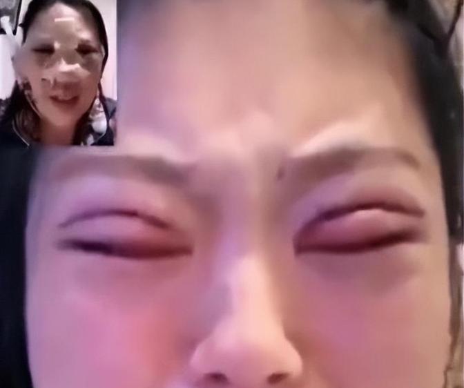 “赔偿1000万，枪毙主治大夫陈某！”北京一女子，在某医院做了双眼皮手术后，觉得