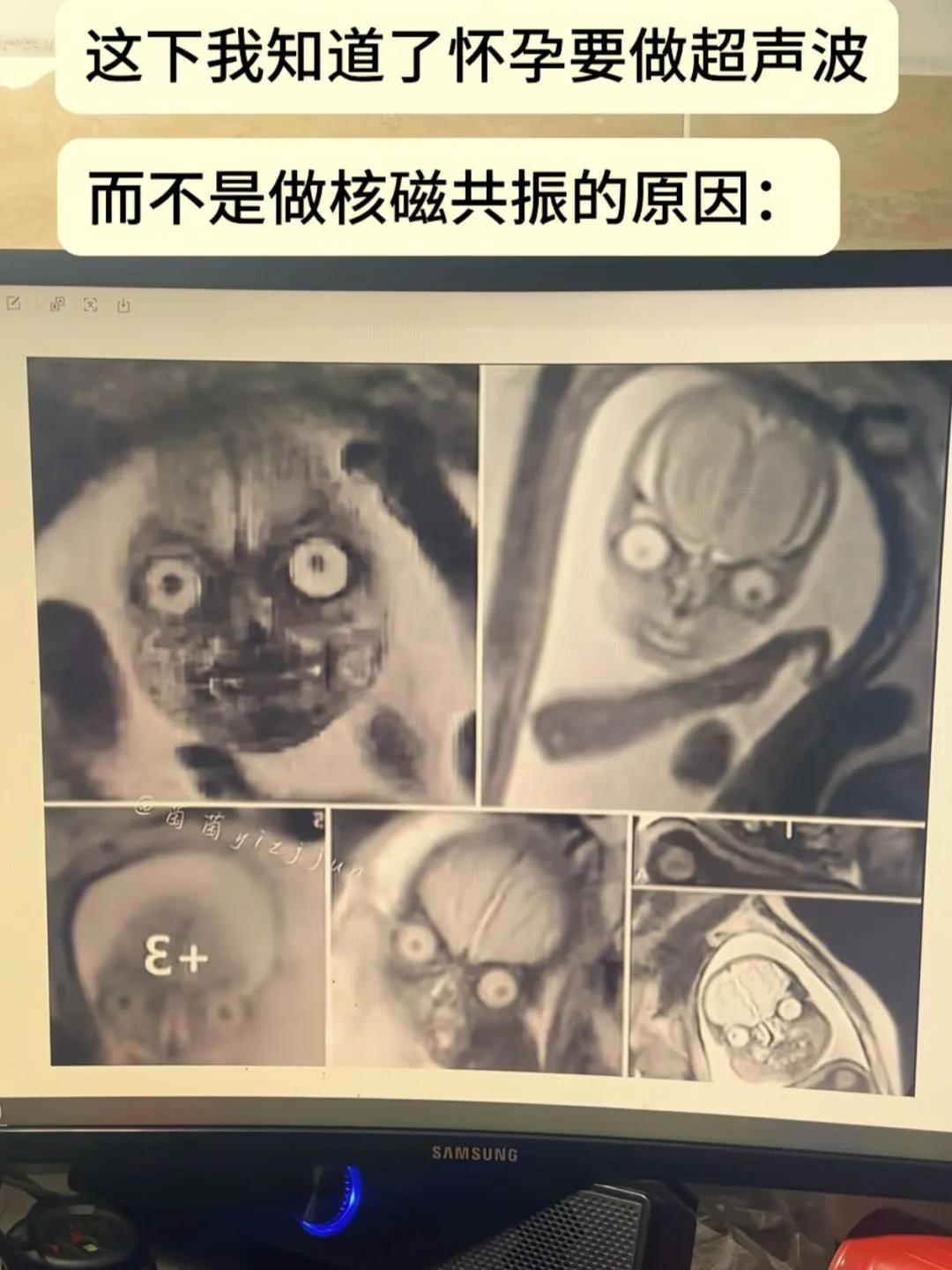 笑死我了，怀孕千万不要做核磁