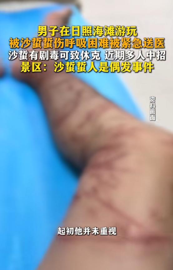 “太吓人了！”8月10日报道，山东日照，一男子在海滩游玩时，双腿突然传来一阵尖锐