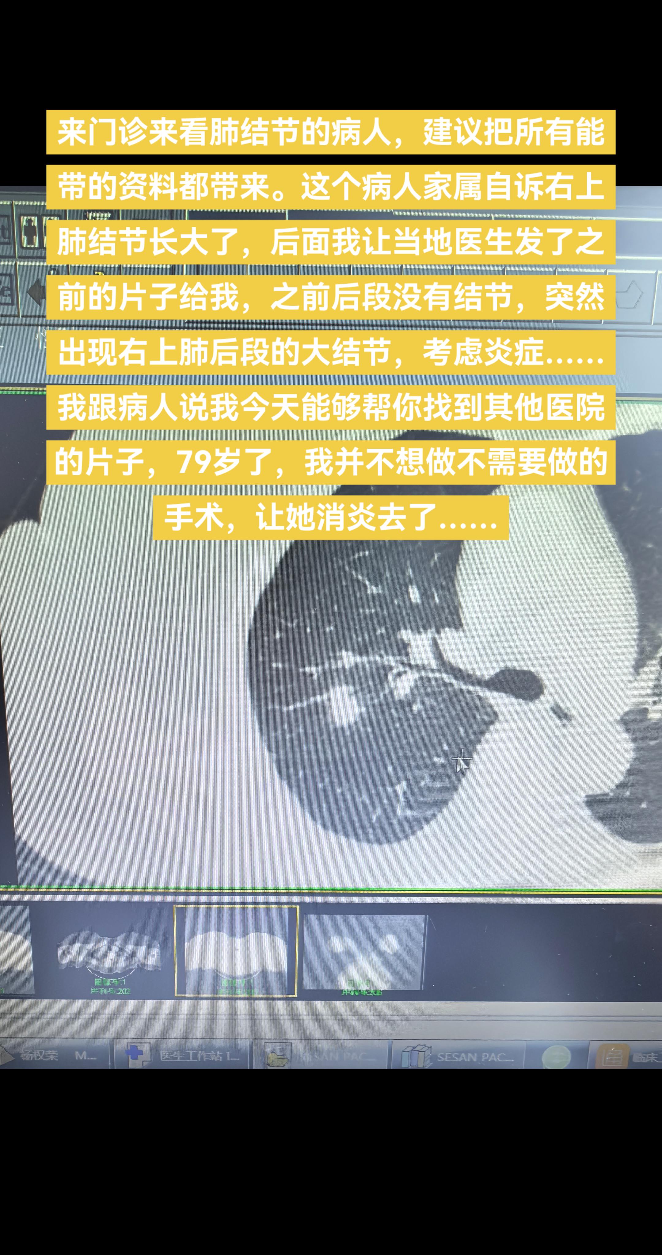 来门诊来看肺结节的病人，建议把所有能带的资料都带来。这是一位79岁高龄...