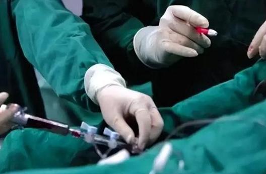 一年前，同学的老公放了一个心脏支架。去年这时候老张刚做完心脏支架手术，天天早上都