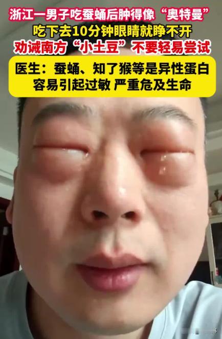 悲剧还是发生了！9月18报道，湖北武汉，41岁男子明知自己吃虾蟹过敏，却想当