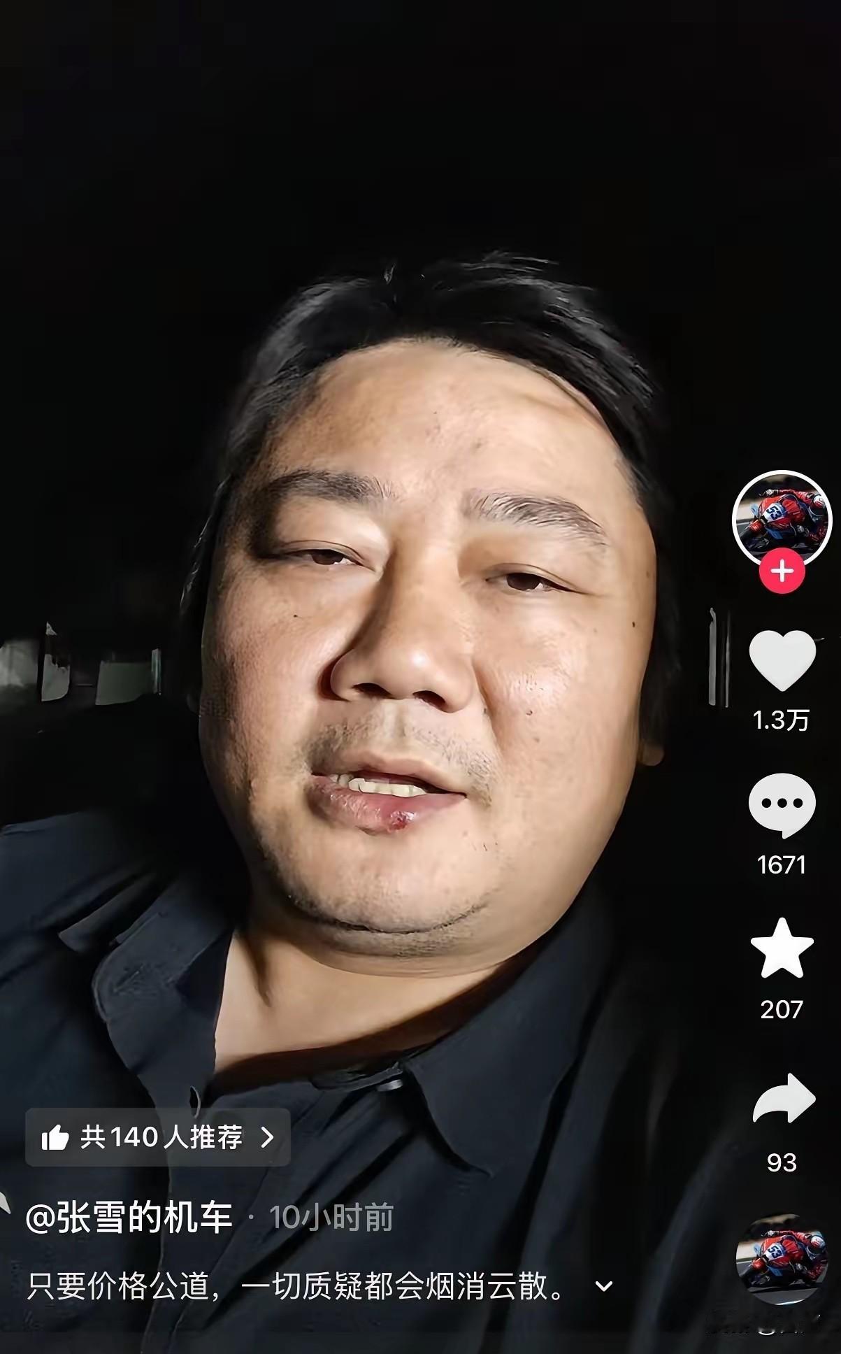 张雪再次力挺韩红！网友们劝张雪不要趟这趟浑水，其实张雪说的也有道理，只要韩红把