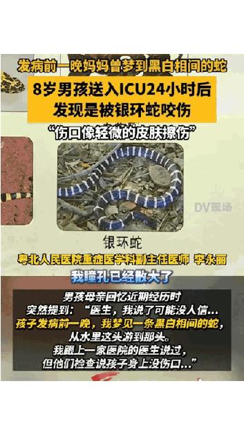 “连医生都解释不清了”！8岁男孩被银环蛇咬伤送进ICU抢救，到医院时已陷入深度昏