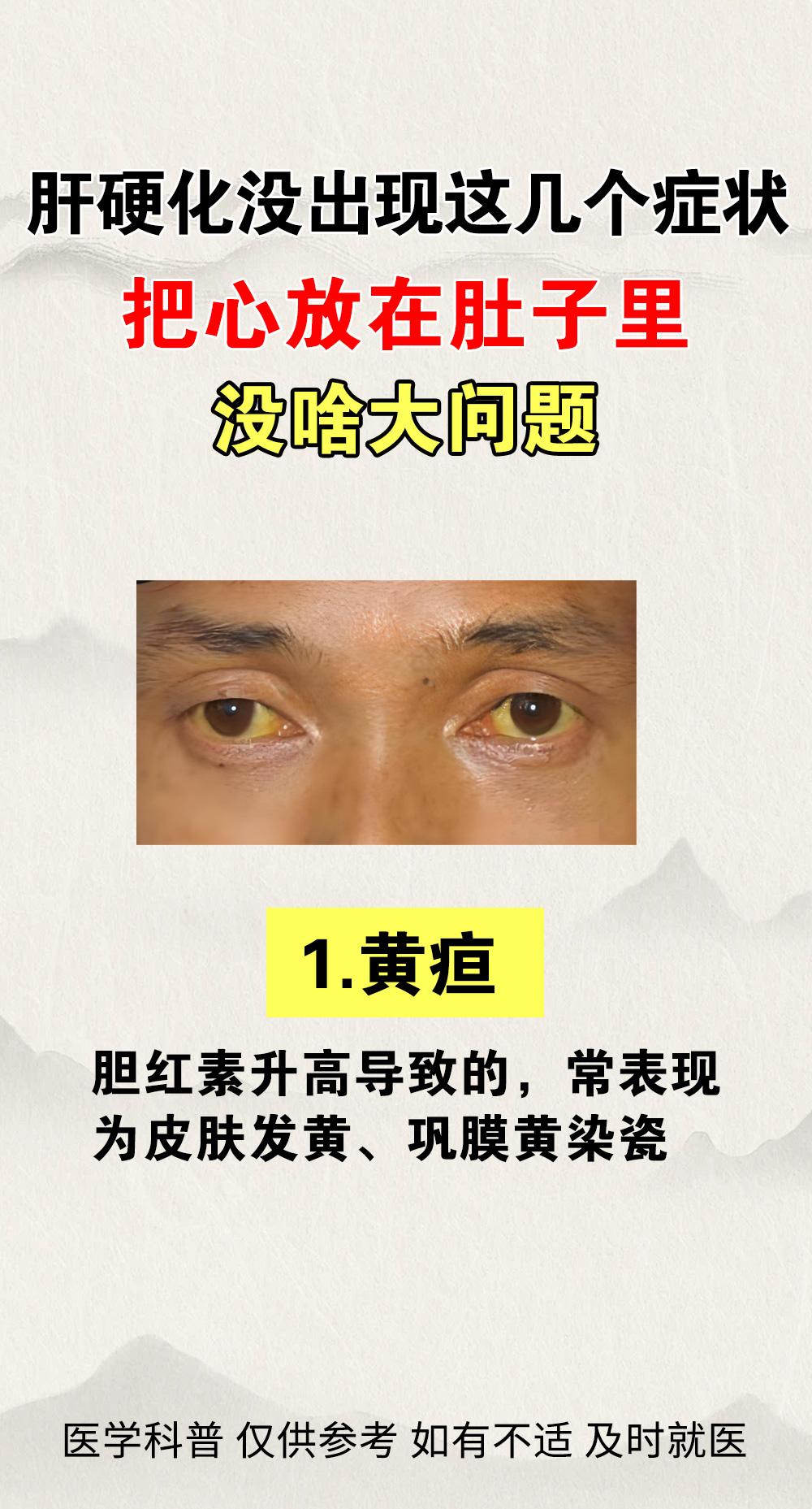 肝硬化没出现这几个症状，把心放肚子里，没啥大问题！