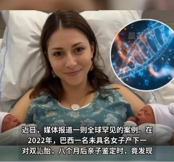 全球也就20例！ 巴西一名19岁女子，在同一个夜晚与两位男性有过亲密接触，怀