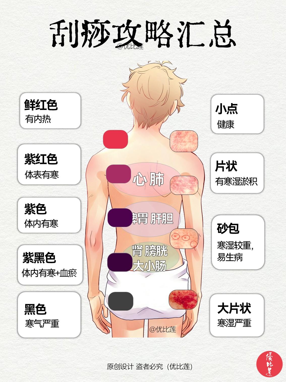 刮痧保姆级攻略【收藏版】，从工具到禁忌，看完这篇全懂了！识别痧：鲜红色：有