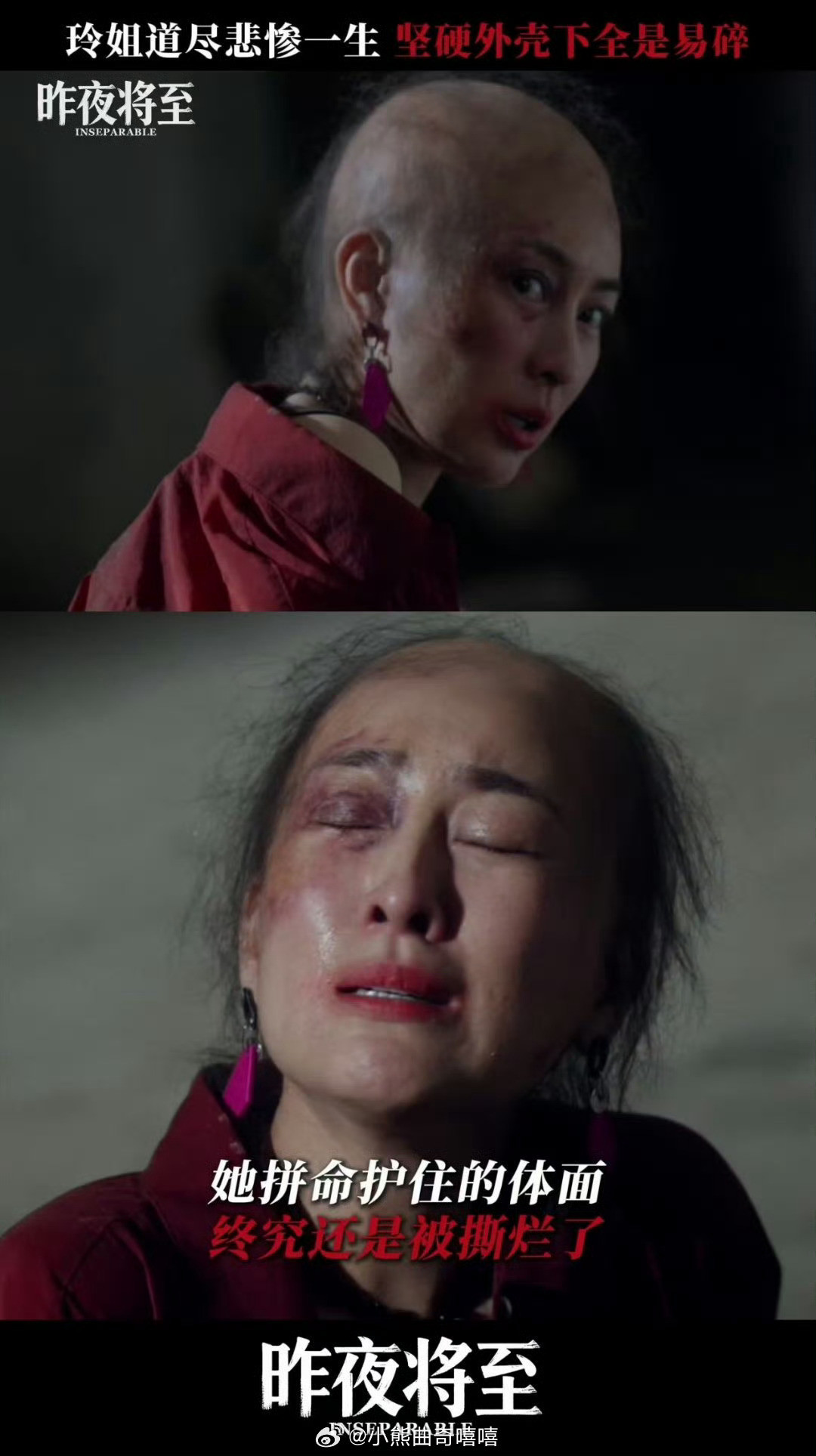 没认出这是马苏昨夜将至差点没认出马苏马苏在新剧里大胆尝试光头形象，素颜出镜，扮相