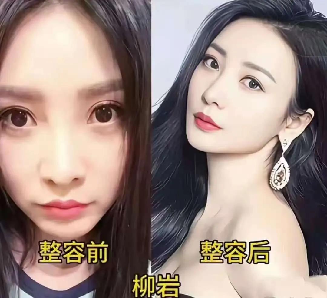 整容前与整容后变化很大的柳岩。整容前与整容后变化很大的杨颖。整容前与整容后变