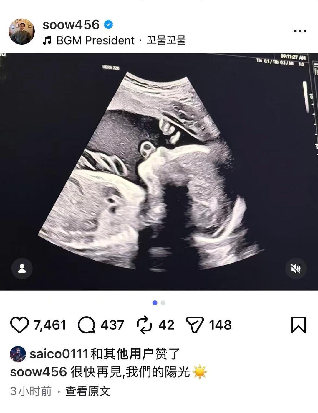 宋承炫宣布当爸谁的青春又圆满了😭前FTIsland宋承炫官宣即将当爸晒出宝宝