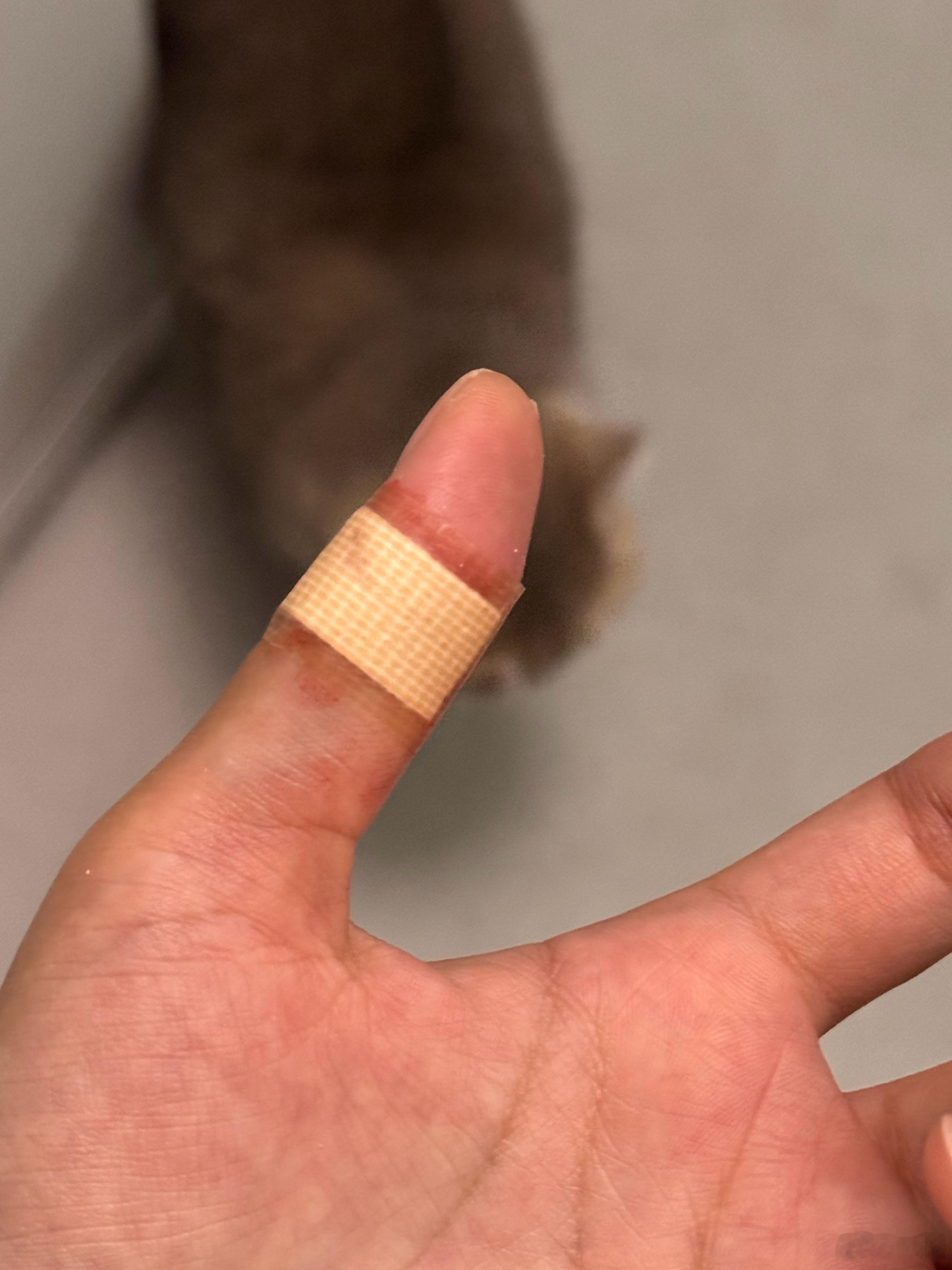 大家要小心这种面包刀，看着不锋利，没想到割的伤口还挺深，痛死了