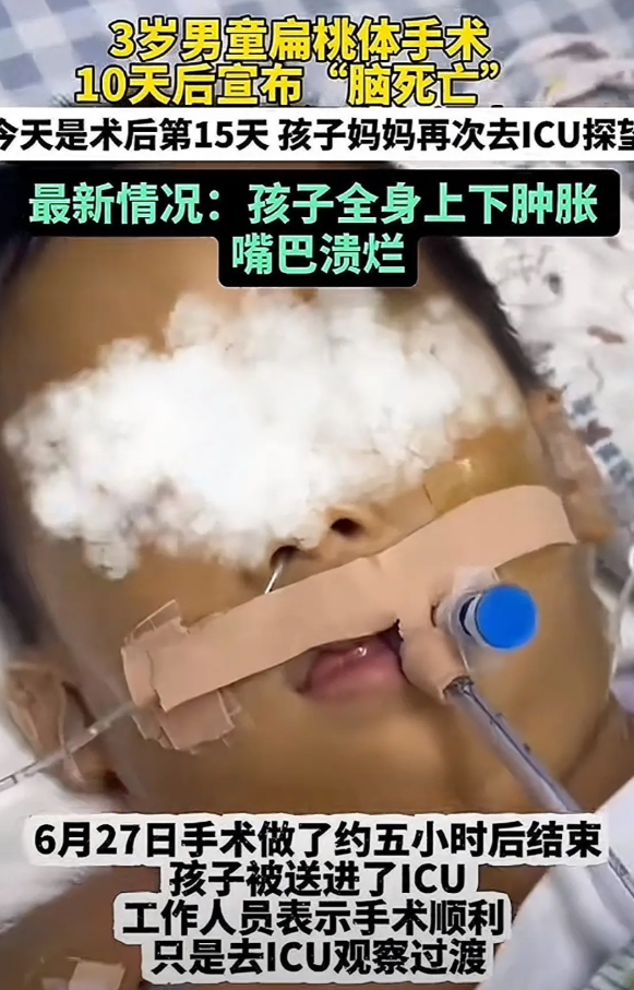 事情搞大了！7月13日广东湛江3岁男童，因扁桃体住院治疗。男孩妈妈担心手术对孩