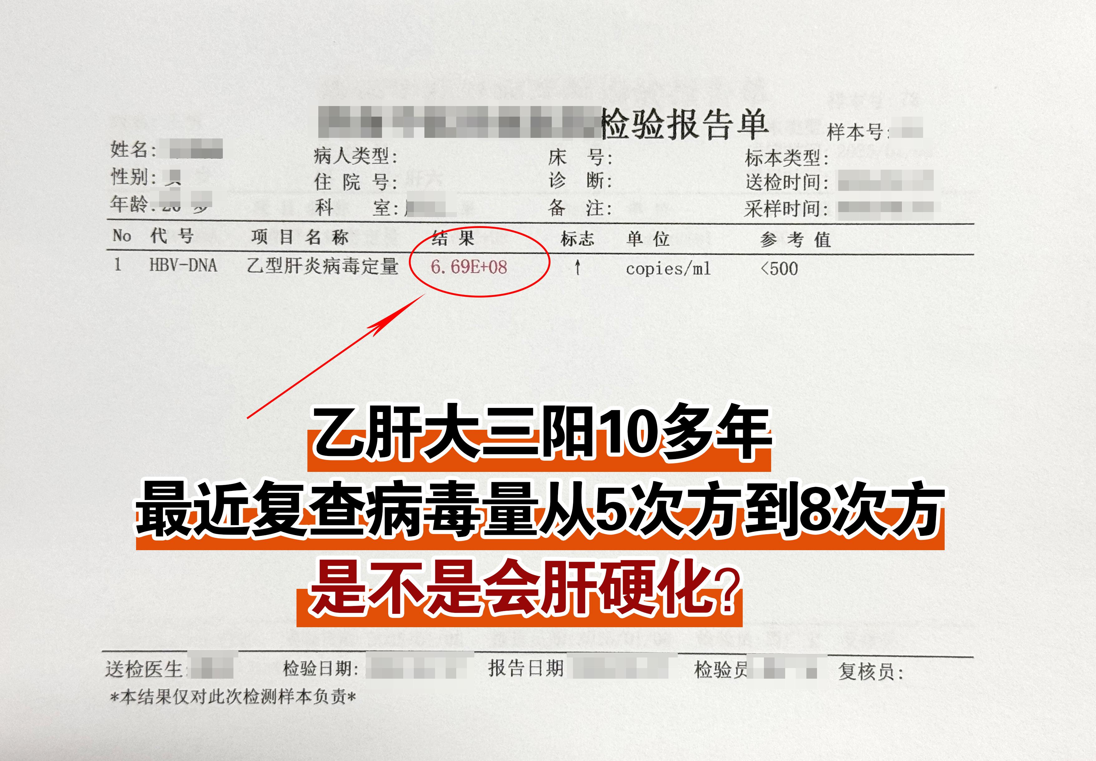 前两天来复查的一位患者，乙肝大三阳10多年了，以前是5次方，肝功能等其...