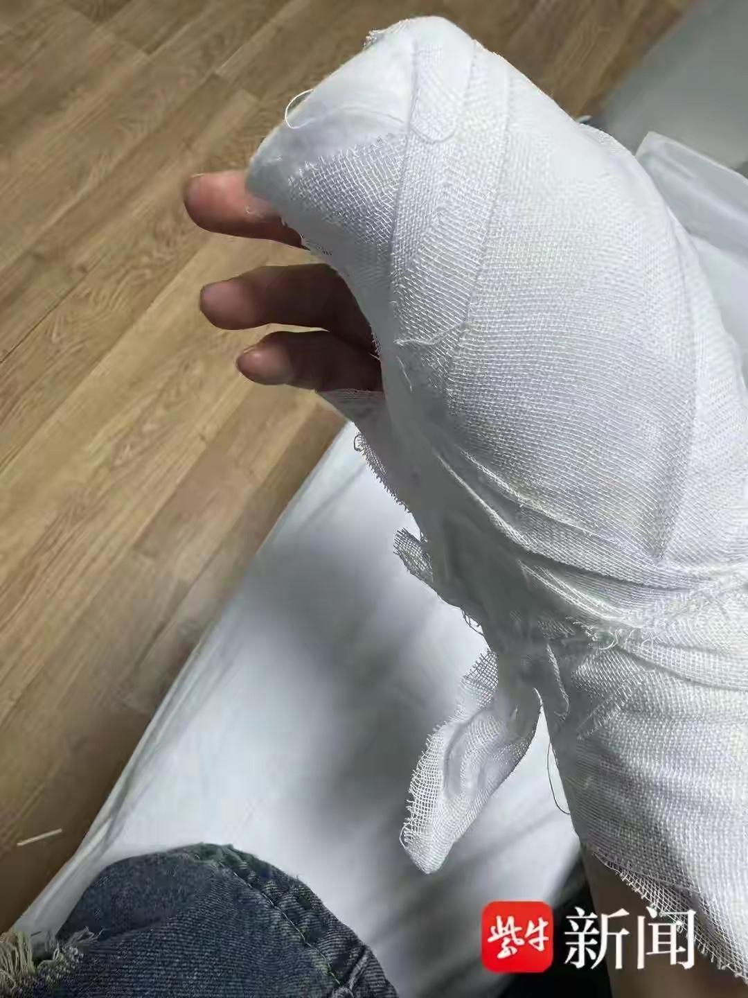 内蒙古，男子花3块多网购一把美工刀，谁料拆快递时，刀尖竟是暴露的，直接划伤了他的