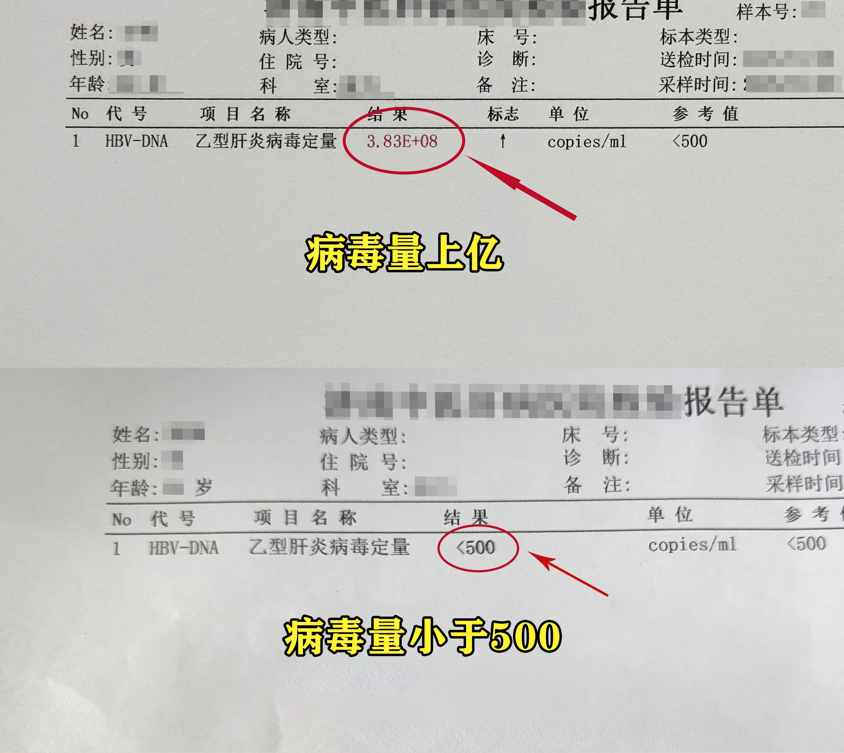 孩子听我的没错吧！。你现在病毒抑制的很不错，才不到半年病毒就降到普通检...