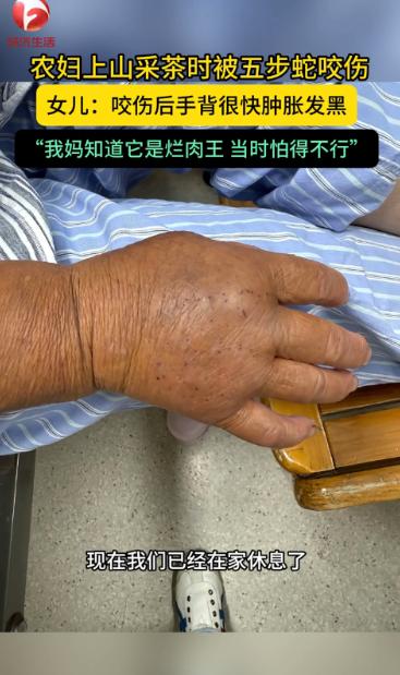 “悲剧还是发生了！”浙江杭州，一女子上山采茶叶时，忽然感觉手被扎了一下，低头一看