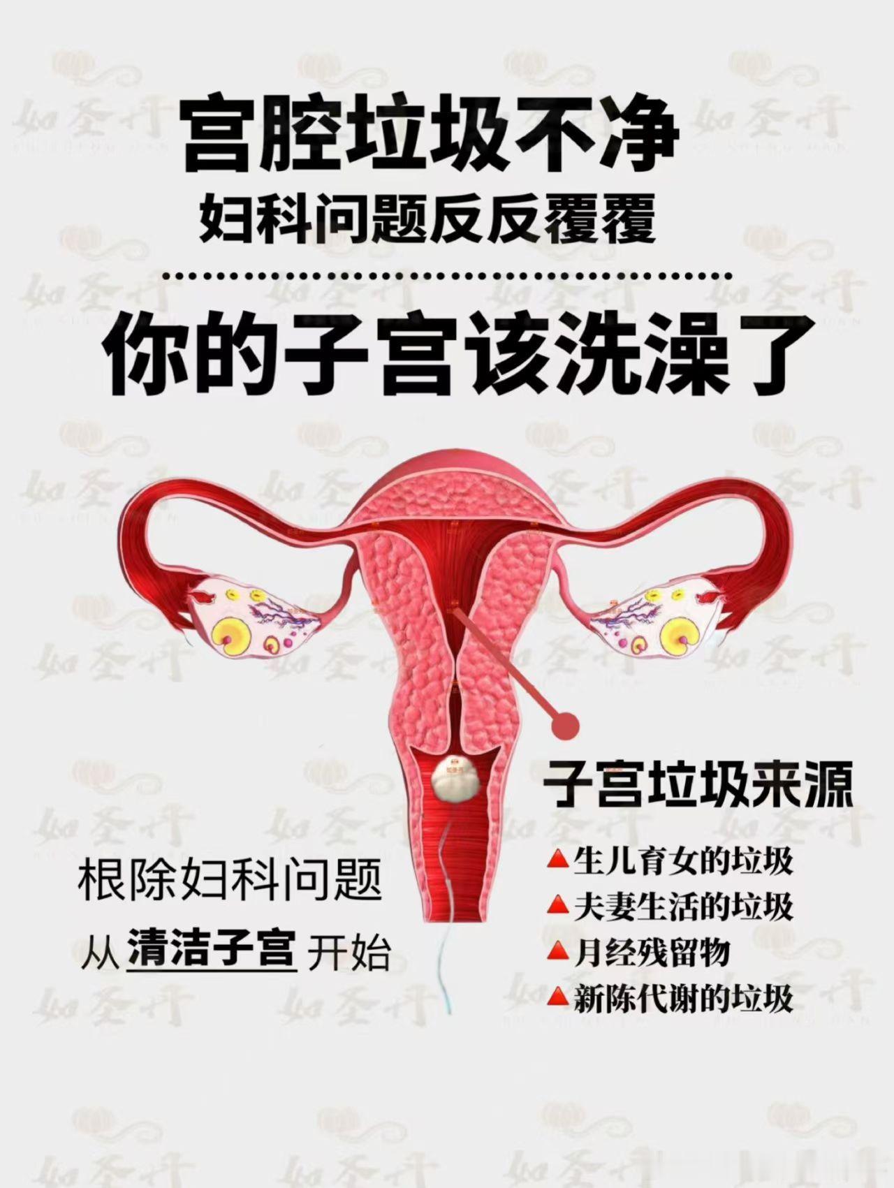 #生活手记#【为什么要用如圣丹？】子宫排毒是女人妇科健康、延缓衰老的根本！没有一个成年女人的子宫是没
