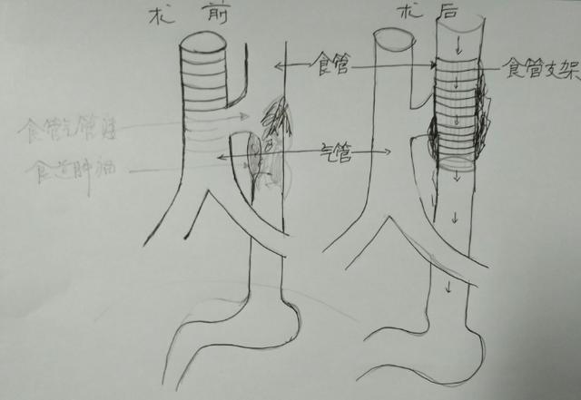 男子食管"上漏下堵"水都喝不了 只因戒不了这件事