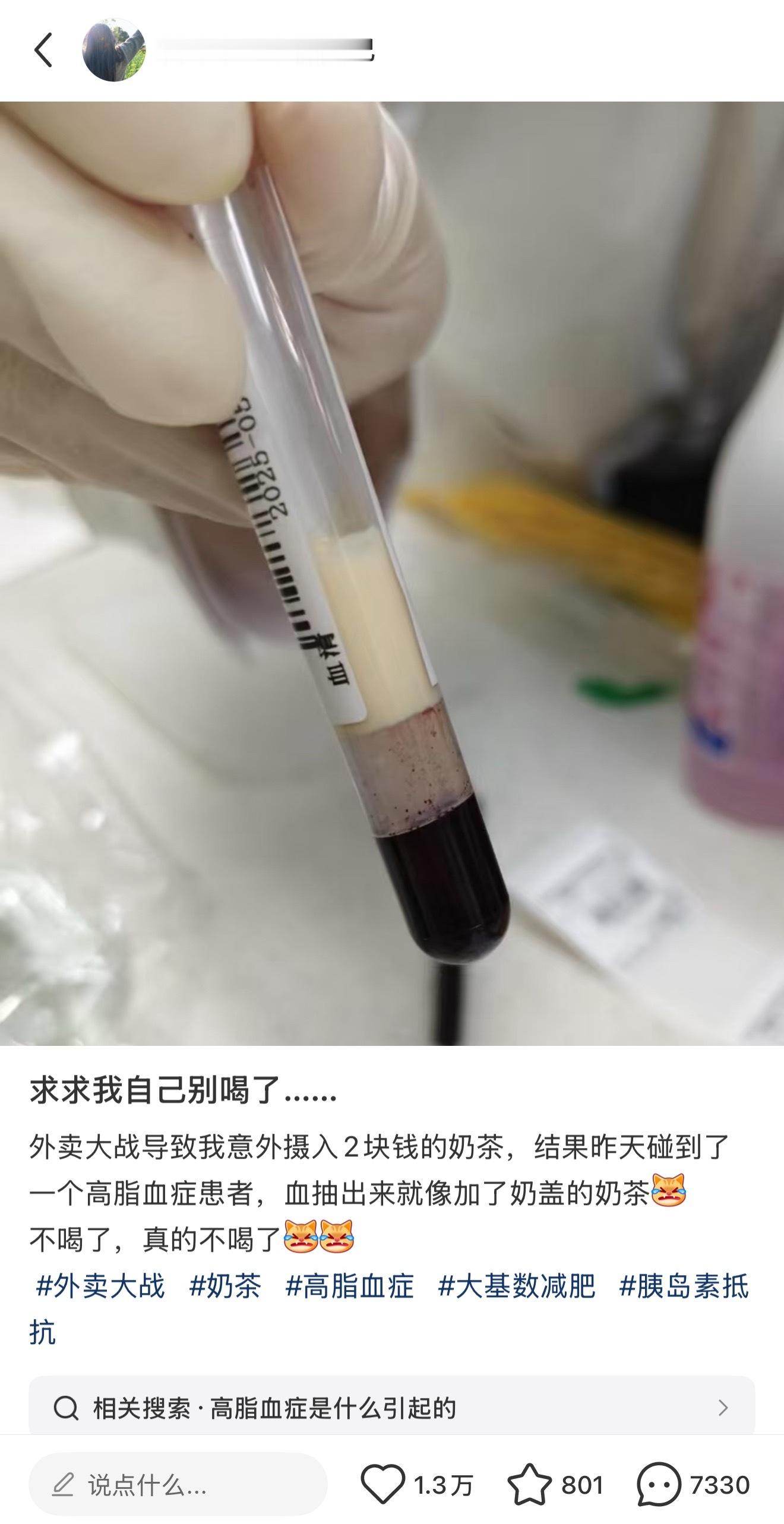 奶茶一天一杯血会不会变这样……（评论区一天一杯目前没这情况​​​