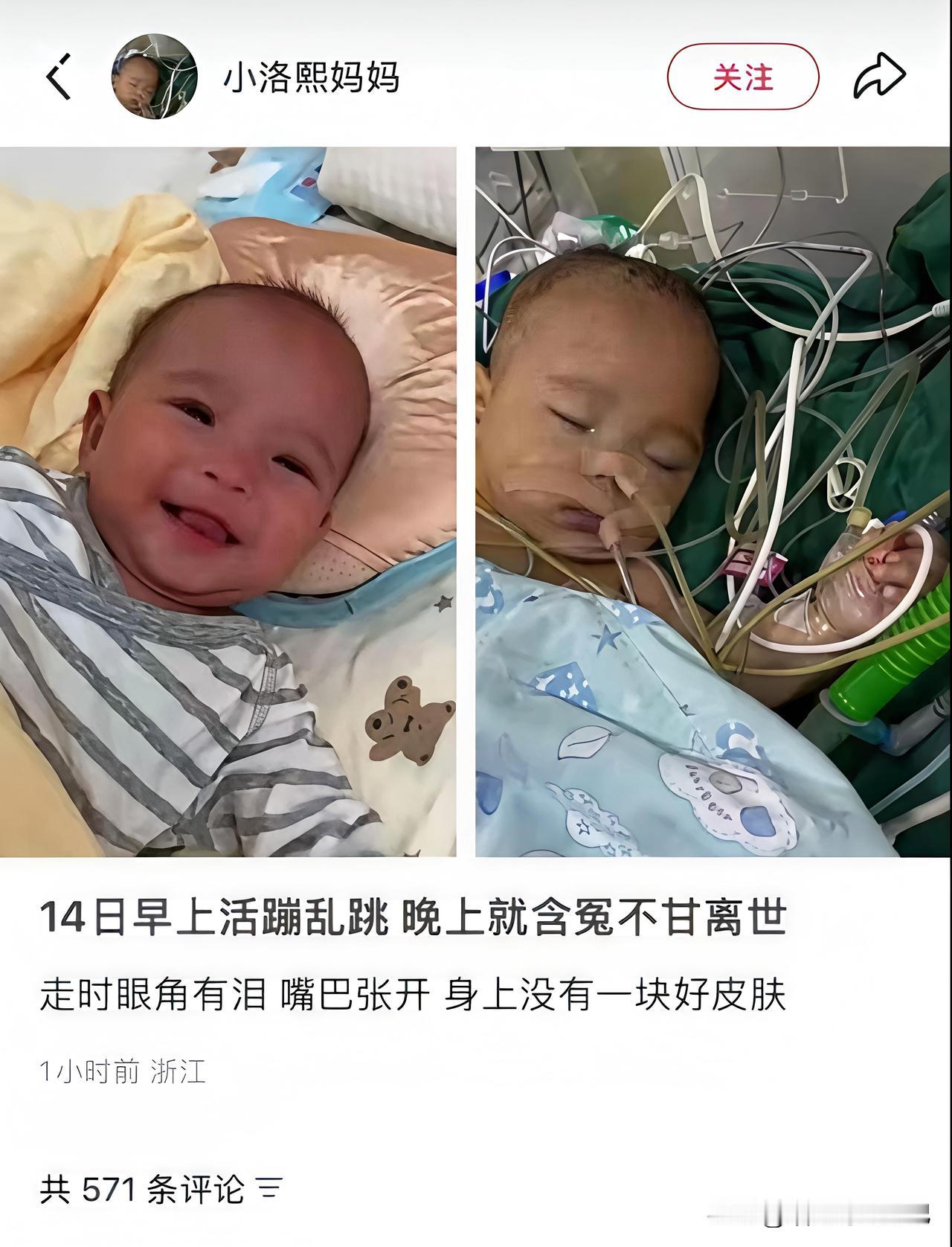 11月14日，宁波5个月早产宝宝小洛熙没能下手术台。由于室间隔缺损，被家长带去宁