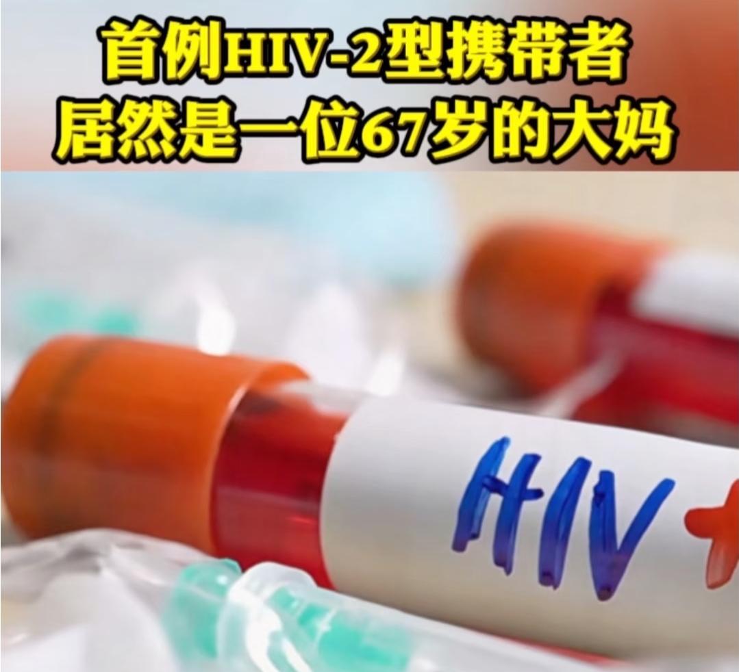 震惊到我了，四川眉山发现首例HIV-2病毒，居然是一名67岁的广场舞大娘。真的是