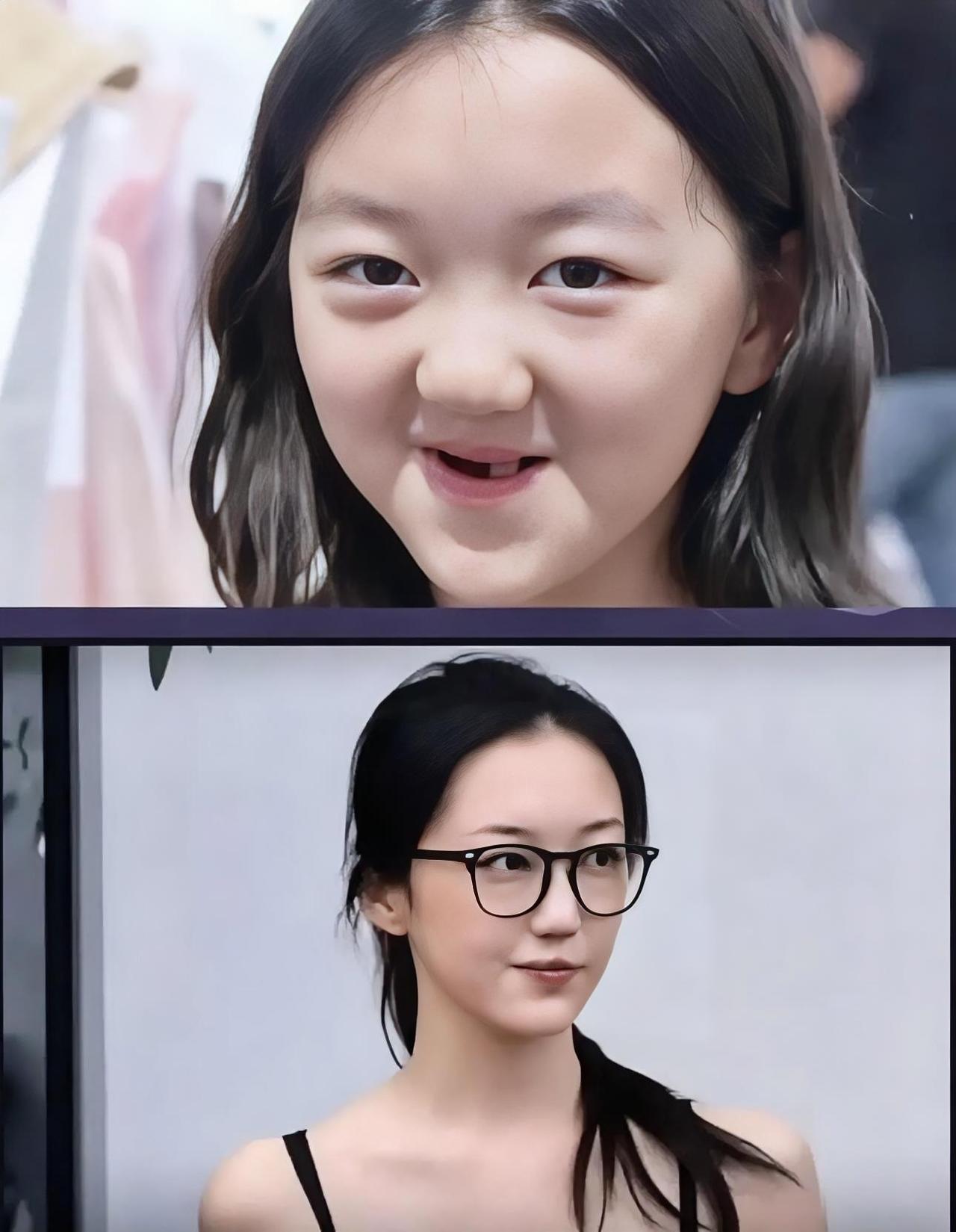 李嫣应该是家族基因是随她奶奶和她奶奶嘴巴一模一样说是隐性兔唇基因她就是