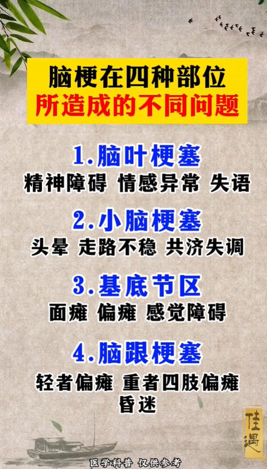 脑梗发病位置不一样，遗留症状有哪些区别？