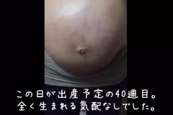 322299711627135956.jpeg?id=0