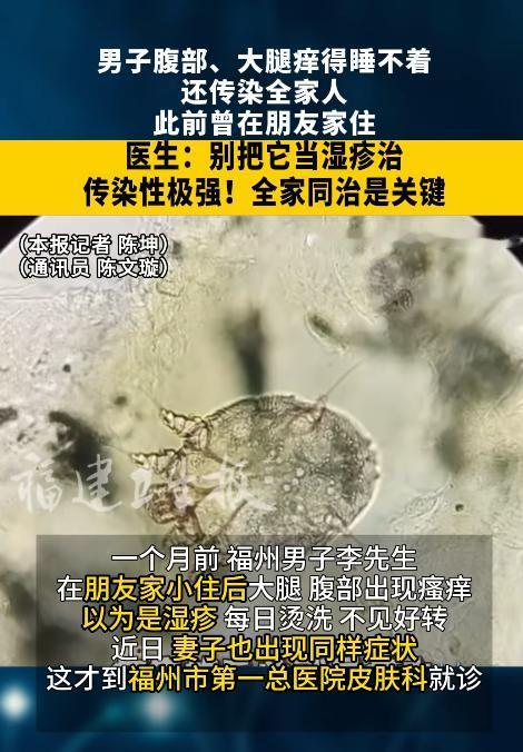 福建一名男子在朋友家借住几天后，腹部和大腿突然瘙痒难忍。他一直当成湿疹，连续用热