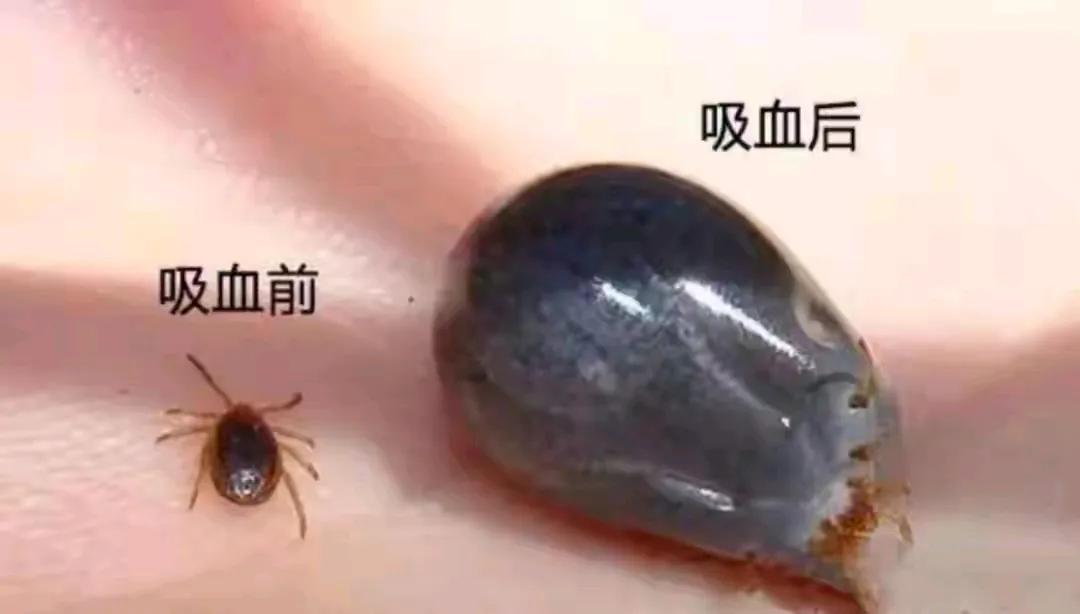 蜱虫一直就有，以前也没有听说过谁被咬了就医的，怎么现在人被咬了就那么严重啊？人们