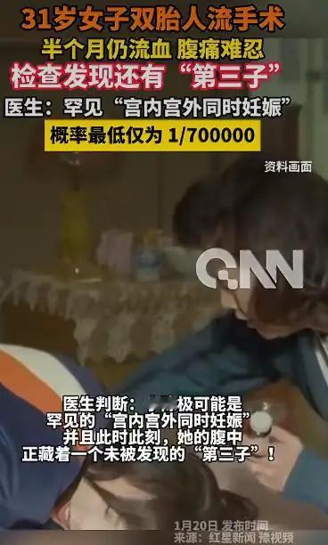 惊天逆转！已育四子妈妈意外双胞胎怀孕，手术后竟发现“隐藏的第三胎”，命悬一线的妇