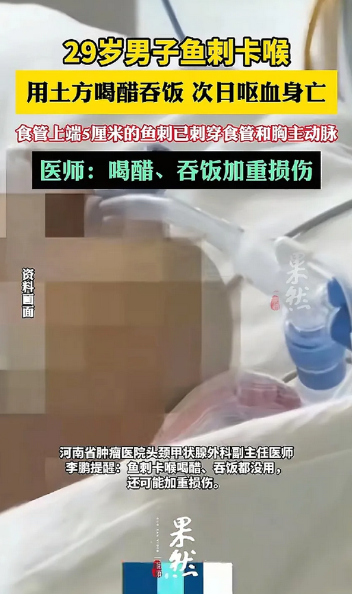 29岁小伙吃鱼卡刺不幸身亡