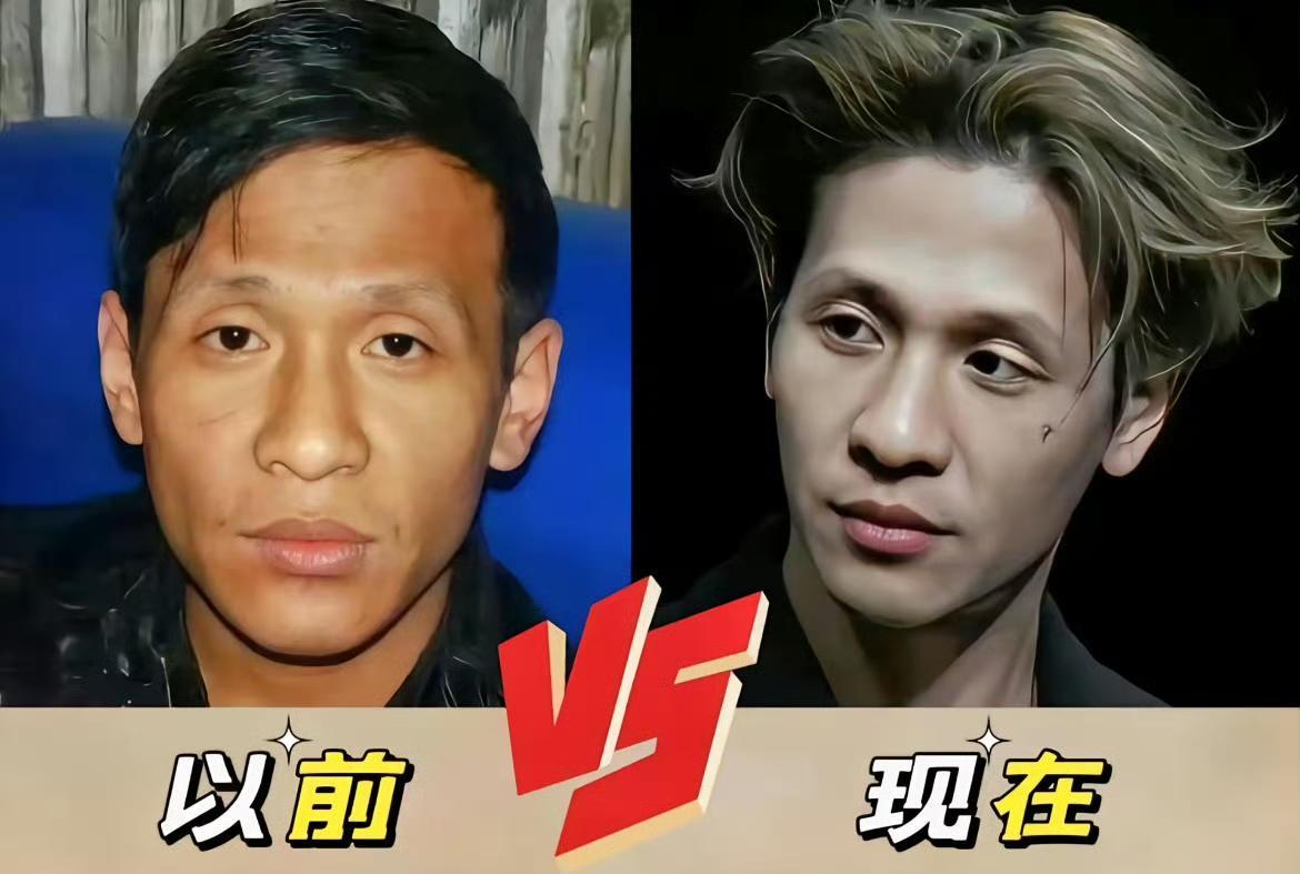 宋小宝脸上动了600多刀。这话一出，底下笑成一片。没人信。都以为是他那个喜