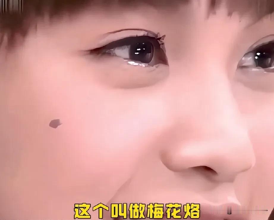 杨丞琳脸上长了一颗梅花痣，成了她的标志，她注定会大红大紫。主持人说这种痣大概