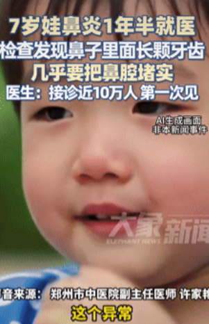 活久见！河南郑州，一7岁男孩因患鼻炎1年半，难受得不行，家长就带着他去医院，不料