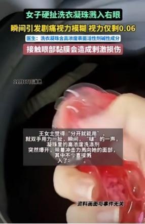 “悲剧还是发生了。”11月报道，浙江杭州，一女子洗衣服时，发现洗衣凝珠黏在了一起