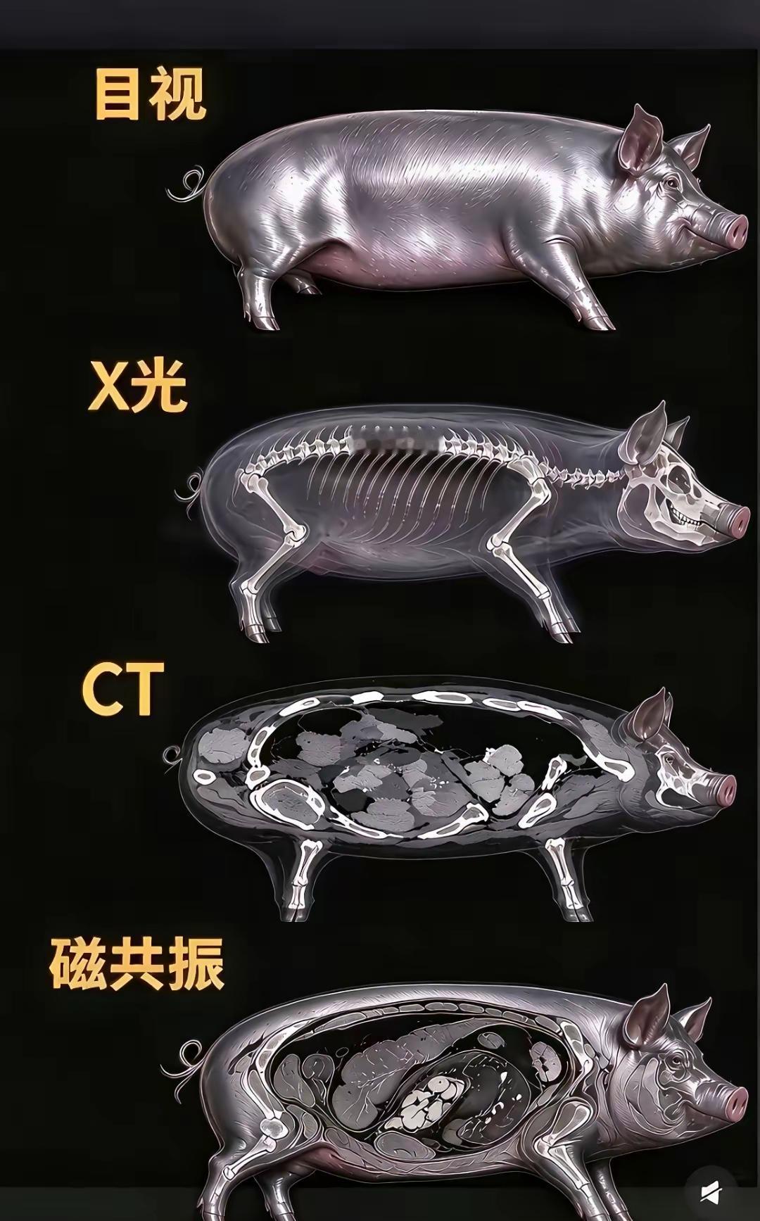 核磁检查贵是有原因的。