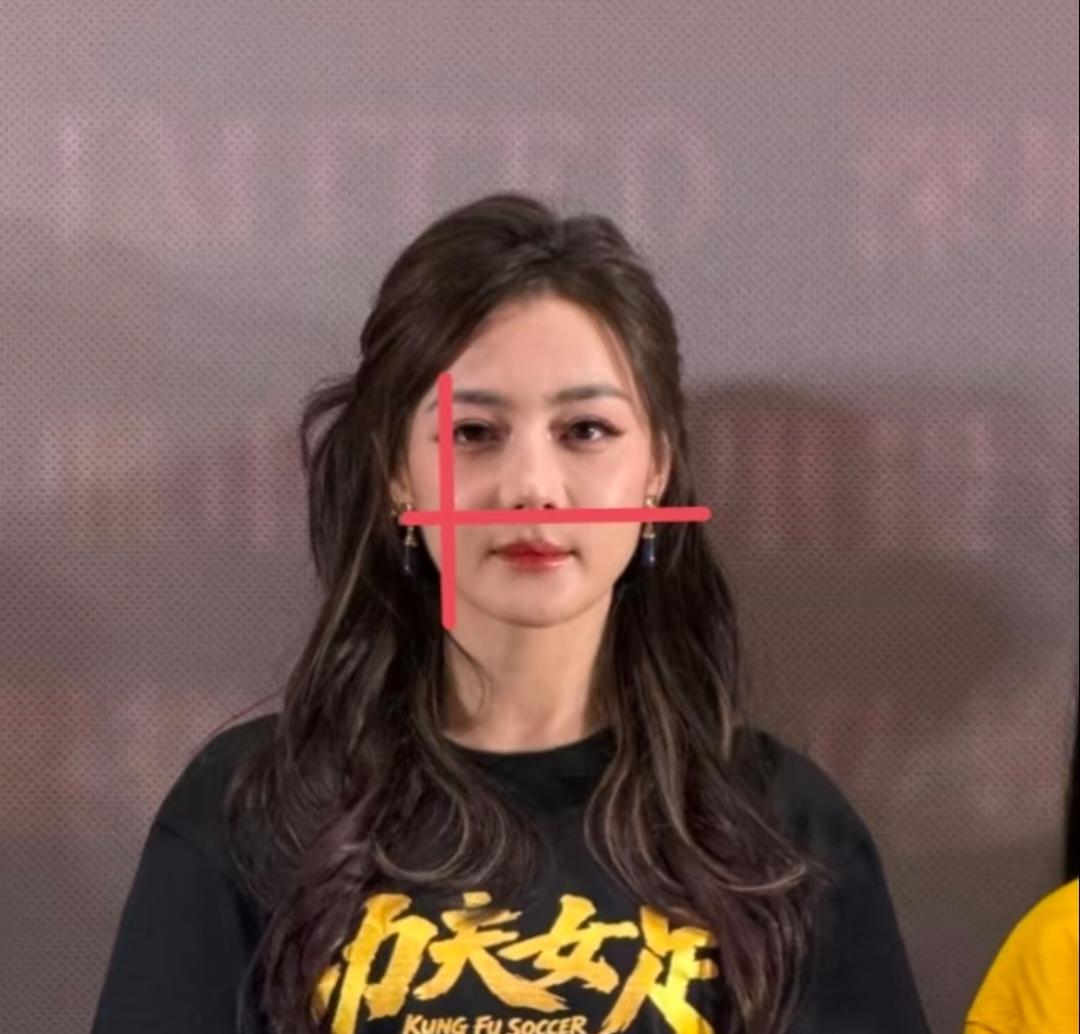 终于明白迪丽热巴变脸的原因了不是医美后遗症也不是胖了而是她年龄大了，苹果肌
