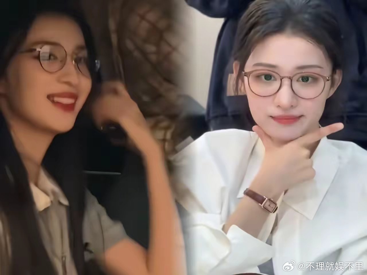 很奇怪，王楚然近视七百多度，可眼球突出、眼眶变大，这些问题在她这儿一点都没有。有