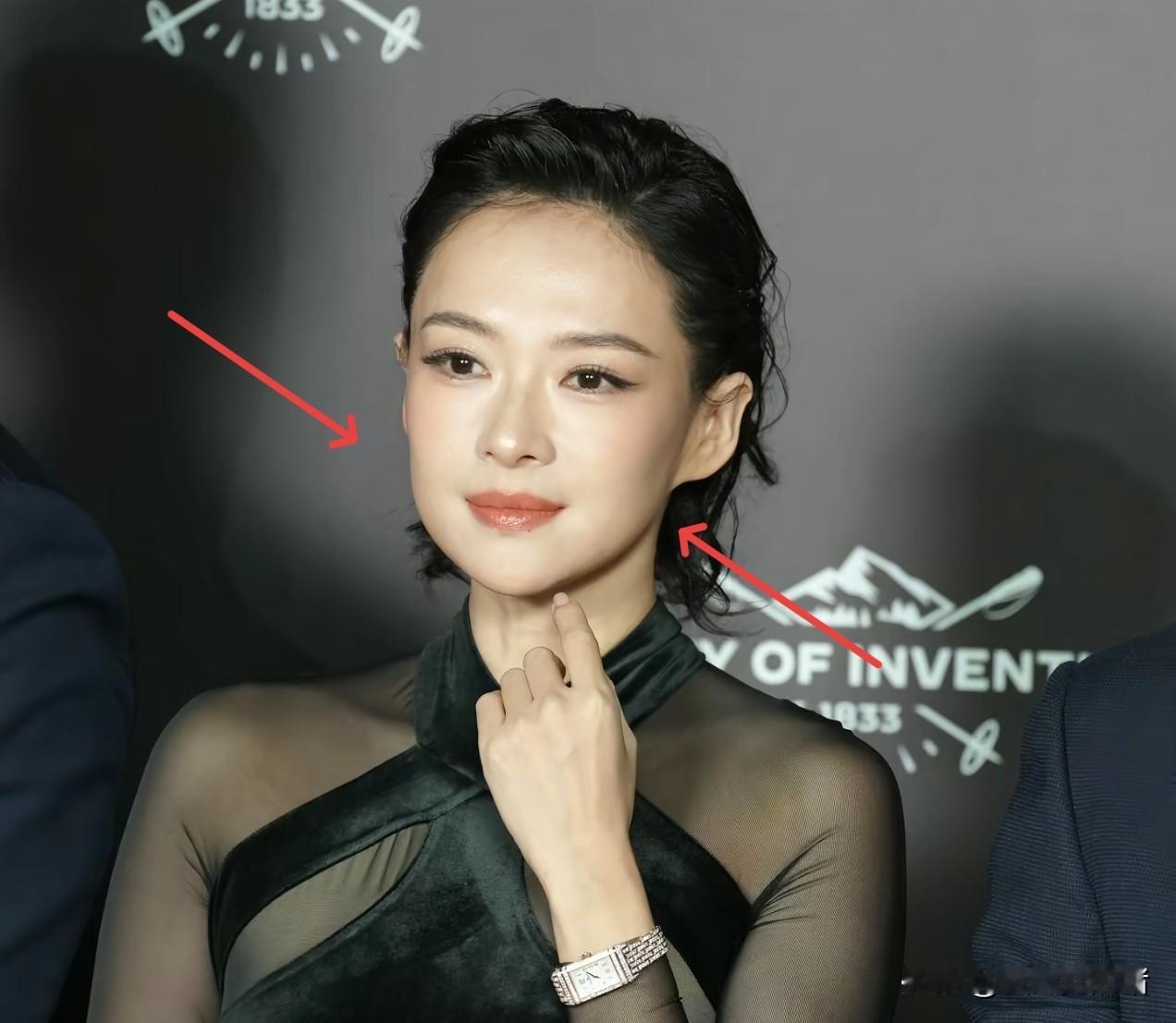 我问在整形医院当护士的闺蜜，章子怡这脸是不是填了？我闺蜜瞟了一眼上海活动的生