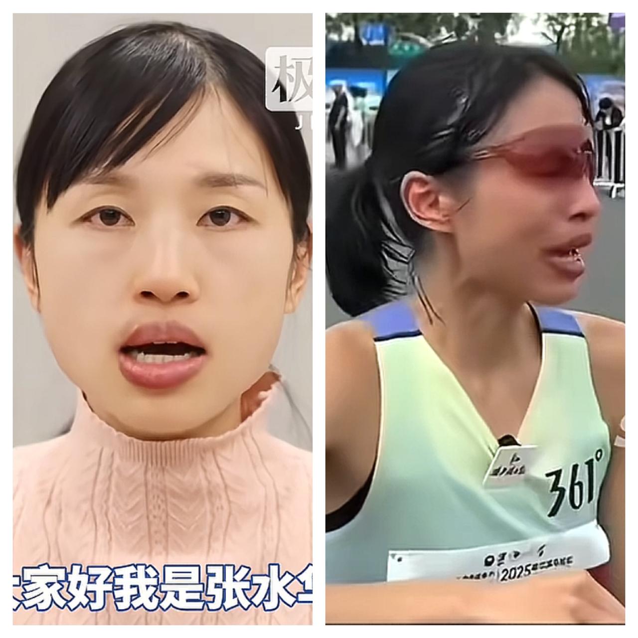 “最快女护士”张水华为什么辞职？原因很简单。不是医院容不下一个“网红”