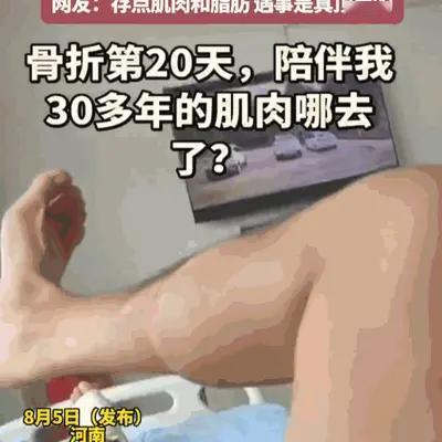 河南一小伙骨折后躺床静养，不料短短20天，练了30年的精壮小腿竟萎缩成了"肥肉"