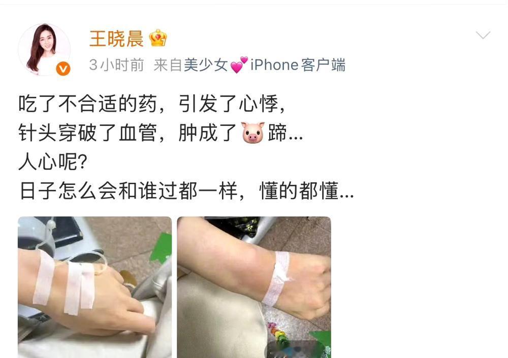 别再替王晓晨可惜了。你看到的“不温不火”，恰恰是她最狠的生存牌。还在猜她和俞灏明