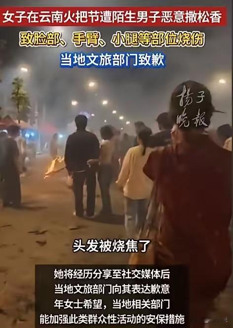 天啊，这么丧心病狂的吗？一女孩去云南体验“火把节”，结果头发被烧焦，小腿&胳膊