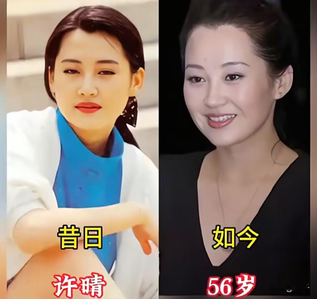 ✨岁月从不败美人｜老牌女星今昔对比翻看这组老照片，真的会被老一辈女演员打动