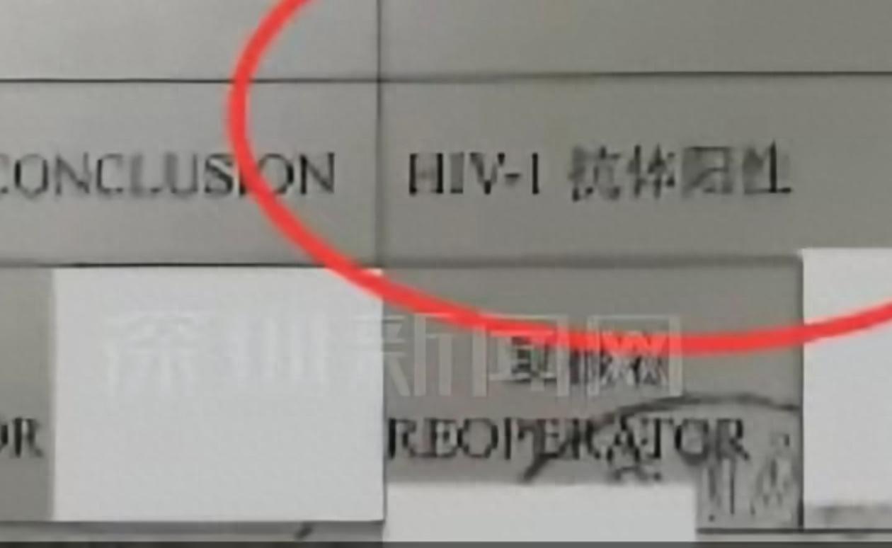 然来，艾滋病也不都是有传染性的，得了病生存期也是很长的。云南人王某与丈夫李某，