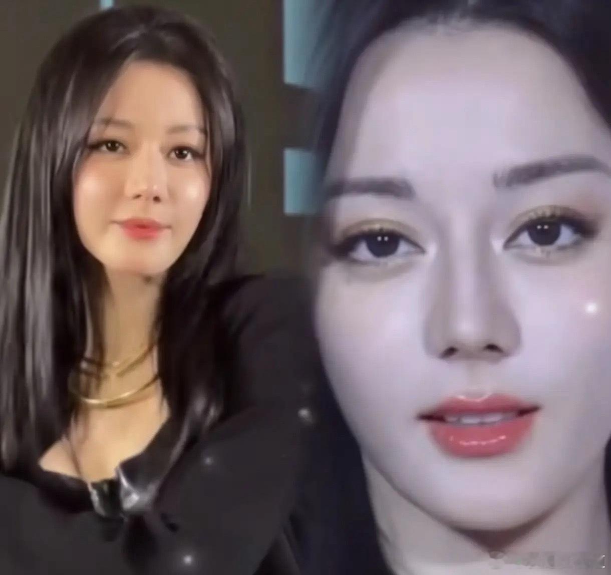 最近迪丽热巴的颜值下跌的离谱，各种猜疑都有，什么医美，过度节食。不过节食估计是很