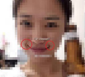 矫情纹，是矫情女孩专有的嘴角纹路（不是绝对，如果一个女人，有矫情纹，但面相中额、