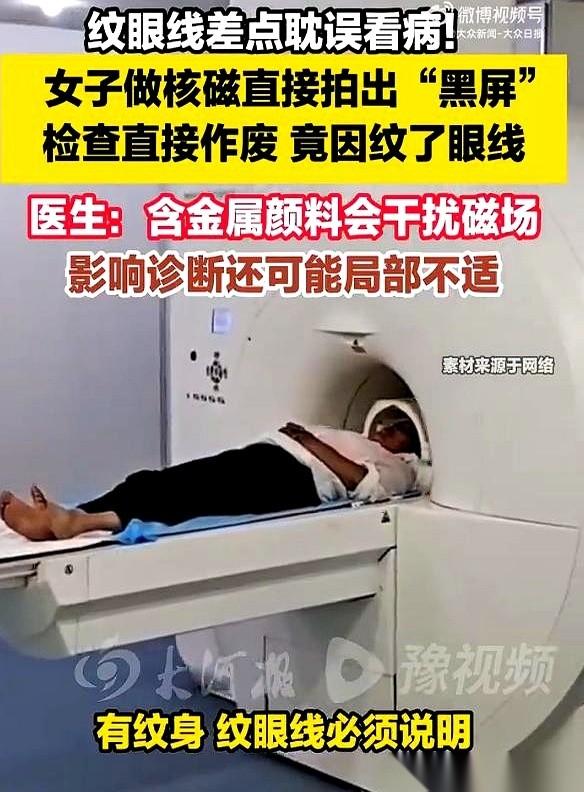 片子打出来的瞬间，看着屏幕上黑乎乎的一团，医生指节敲得桌子梆梆响：“眼皮不想要了